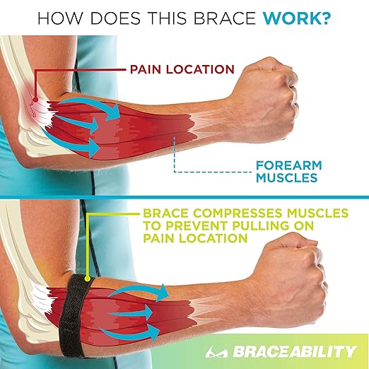 BraceAbility Epicondylitis Brace | Elbow Strap for Medial/Lateral Epicondyle Pain and Tendonitis Arm Compression Support Band for Men or Women (One Size Fits Most)